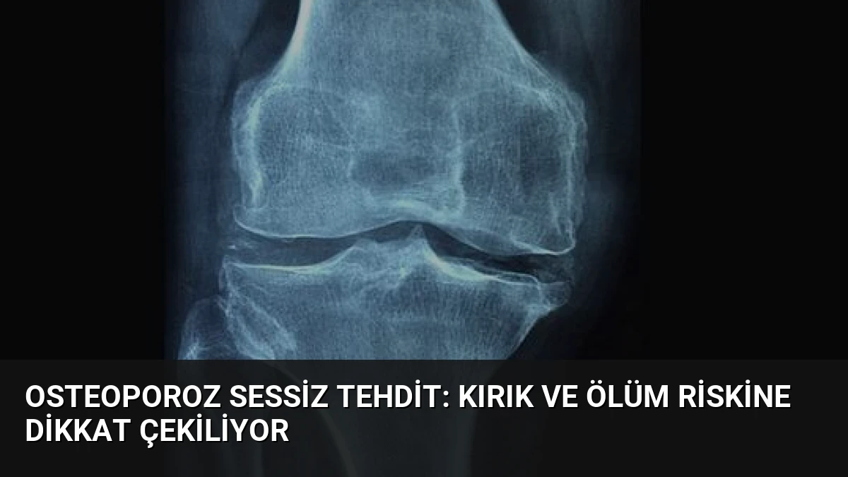 Osteoporoz Sessiz Tehdit: Kırık ve Ölüm Riskine Dikkat Çekiliyor