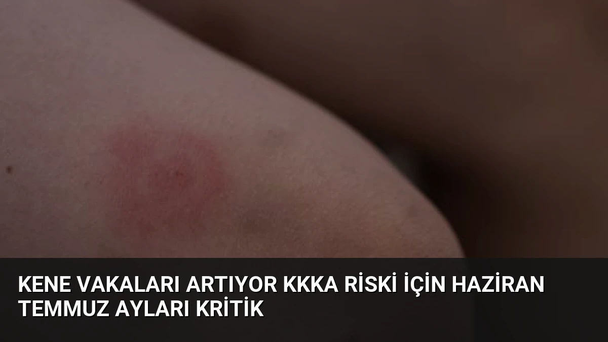 Kene Vakaları Artıyor KKKA Riski İçin Haziran Temmuz Ayları Kritik