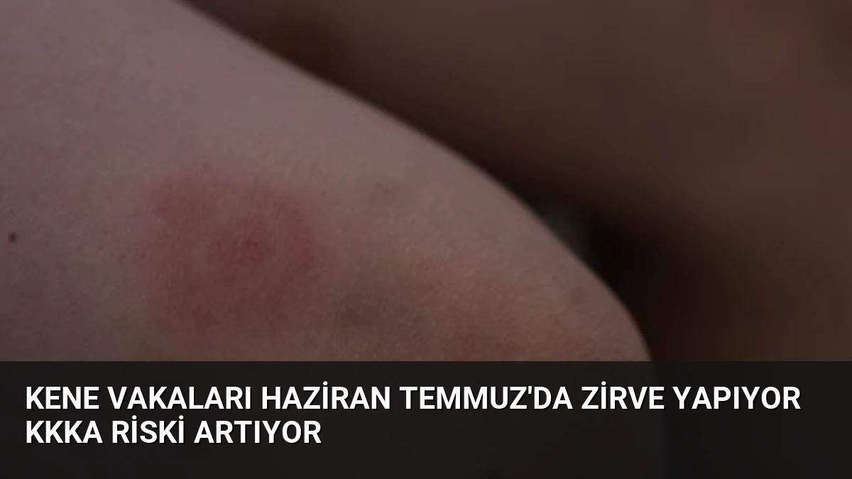 Kene Vakaları Haziran Temmuz’da Zirve Yapıyor KKKA Riski Artıyor