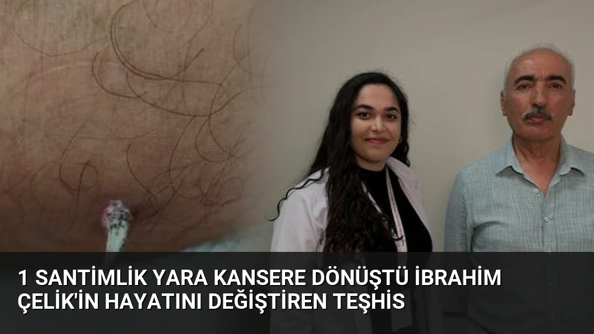 1 Santimlik Yara Kansere Dönüştü İbrahim Çelik’in Hayatını Değiştiren Teşhis