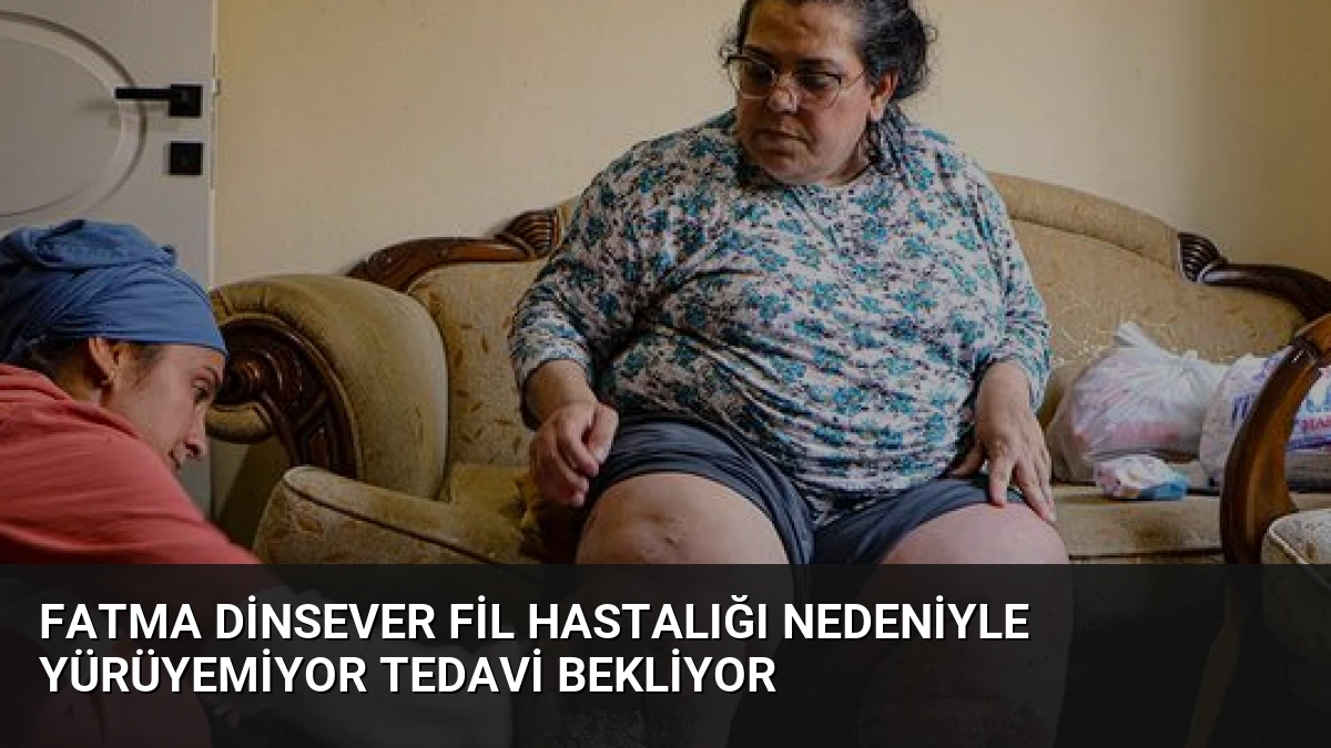 Fatma Dinsever Fil Hastalığı Nedeniyle Yürüyemiyor Tedavi Bekliyor