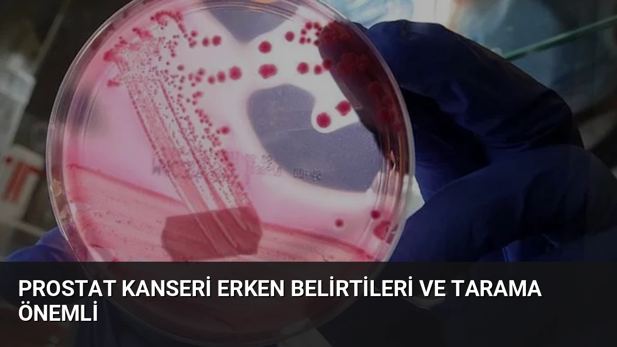 Prostat Kanseri Erken Belirtileri ve Tarama Önemli